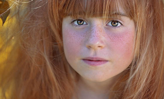 5 child freckles