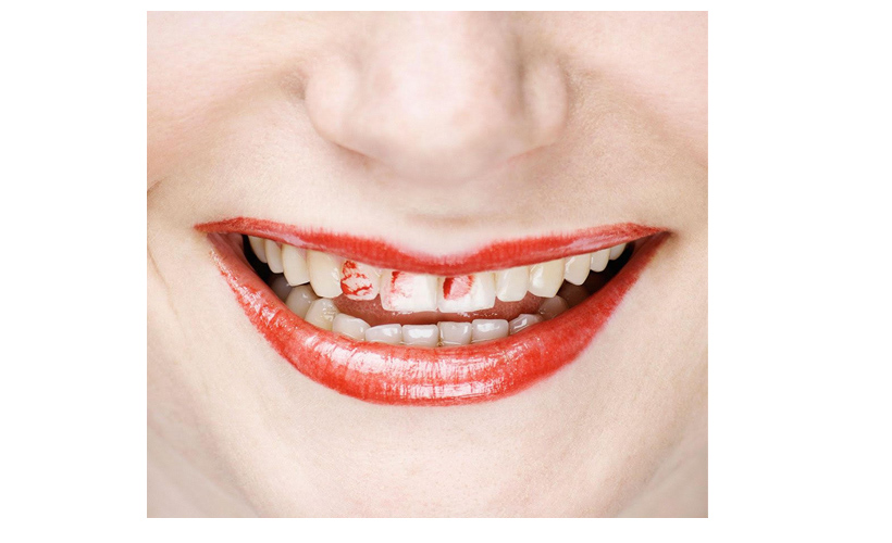 Reductress » 5 Bold Red Lipsticks To Empower Your Front Tooth